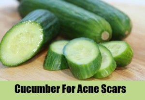 cocumber home remedy for acne